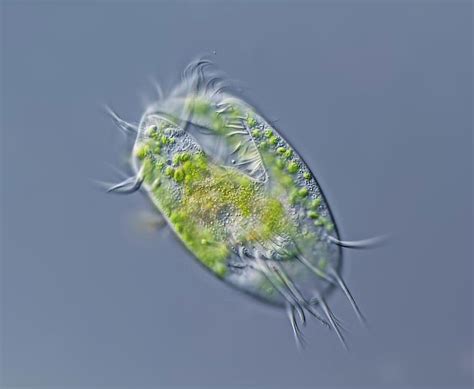  Euplotes! A Ciliate Superhero Disguised as a Tiny Speckle